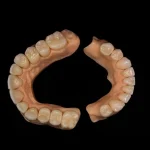 Arcadas completas de zirconia - Image 2